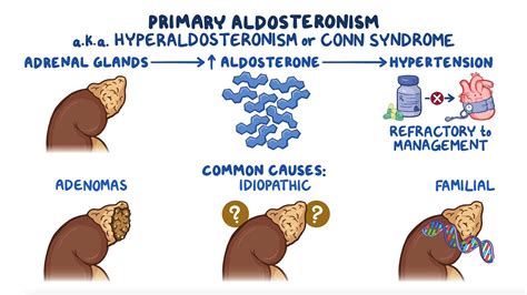 Visinin-like 1 (VSNL1) is upregulated in aldosterone-producing adenomas (APA) compared to normal adrenals. . Neonatal hyperaldosteronism